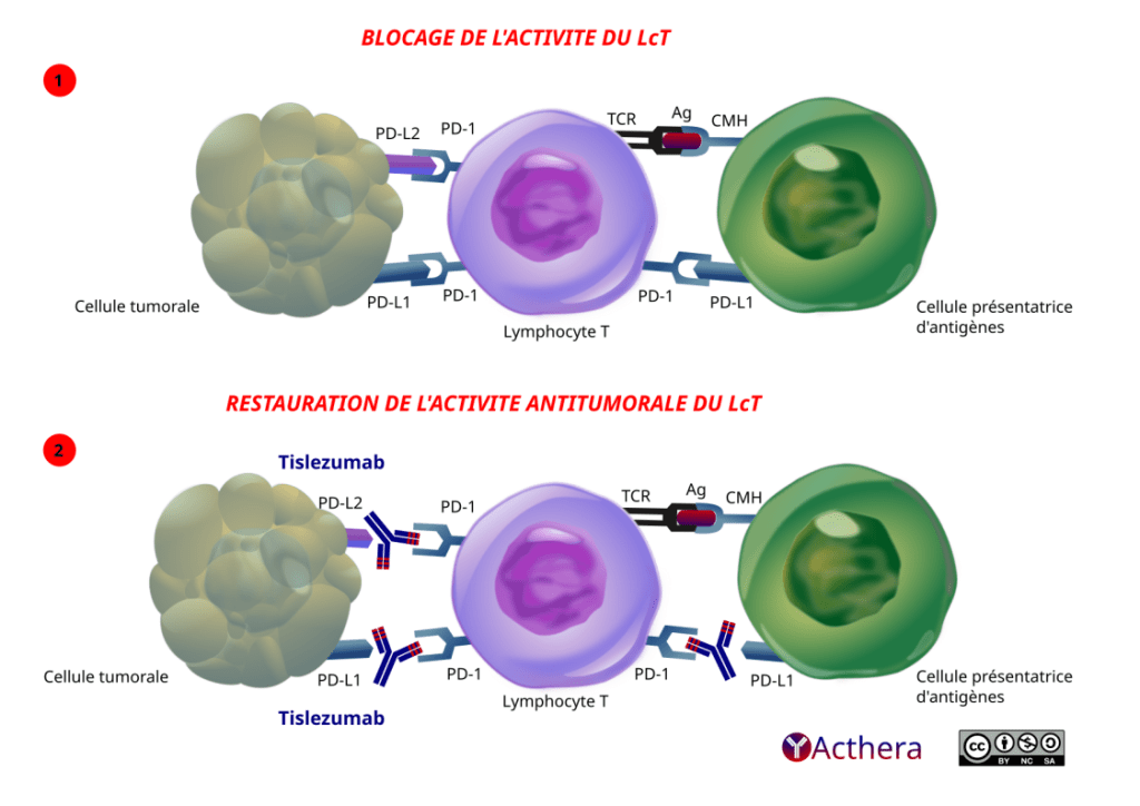 [UMBRELLA] TISLELIZUMAB chez les patients atteints de cancer avec maladie résiduelle moléculaire